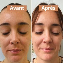 Sérum visage purifiant