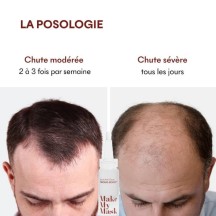 Sérum Anti-Chute Tricho-Boost
