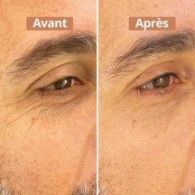 Sérum contour des yeux