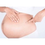 Soins vergetures naturels | Prévention et réparation | Univers Emilie